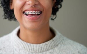 best colors to get for braces