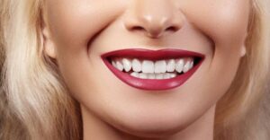 free dental implant programs