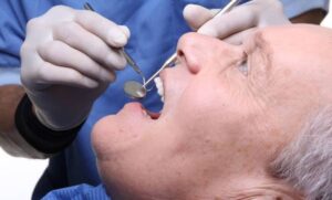 free dental implants for veteran